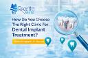 How Do You Choose The Right Clinic For Dental Implant Treatment?