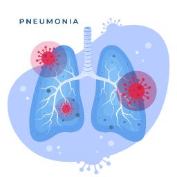 What Are the Best Treatments for Pneumonia?
