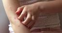 How Does Ivermectin Work in the Body?
