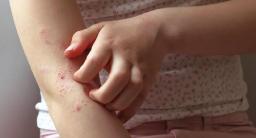 How Does Ivermectin Work in the Body?