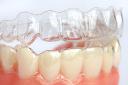 Why Invisalign Is the Preferred Choice for Adults and Teens