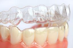 Why Invisalign Is the Preferred Choice for Adults and Teens
