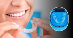Top Benefits of Choosing Invisalign for a Discreet Smile Transformation