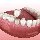 Why Dental Bridges Are a Popular Choice in Restorative Dentistry rated a 5
