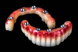 Full Arch Dental Implants: A Complete Smile Restoration Guide