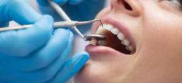 General Dentistry Services Every Family Should Know About