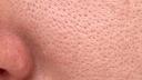 The Complete Guide to Open Pores: Solutions, Treatments & Skincare That Actually Works