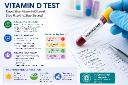 Vitamin D Test: Importance, Benefits, and What the Results Mean