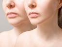 A Cosmetic Treatment to Make You Look Younger