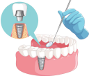 Benefits of Dental Implants: Why They Are the Preferred Choice for Tooth Replacement in New Orleans