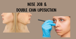 Redefine Your Profile with Nose Surgery and Double Chin Liposuction in Chicago