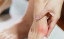 How Seeing a Foot Specialist Early Can Prevent Serious Foot Issues