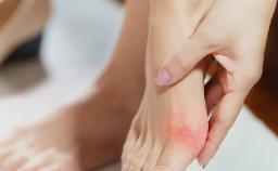 How Seeing a Foot Specialist Early Can Prevent Serious Foot Issues