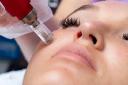 Discover the Secret to Radiant Skin: Microneedling in Frisco