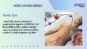 ECMO Systems Market Trends, Business Revenue Forecast and Statistics, Growth Prospective