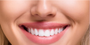 Full Mouth Dental Implants in India – Restoring Your Smile, Confidence & Comfort