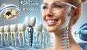 Why Dental Implants Are The Best Tooth Replacement Option?