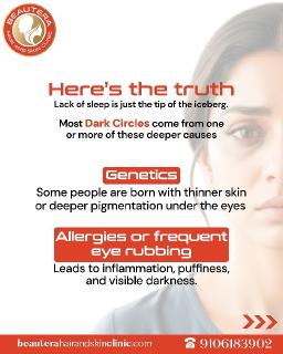 Pigmentation Treatment in Mumbai: Achieving Even-Toned Skin at Beautera Hair and Skin Clinic