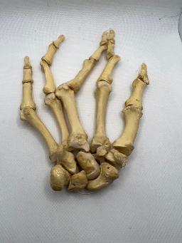 Real Human Left Hand 102 Bones For Sale