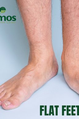 Plantar Wart Hands Perth Amboy