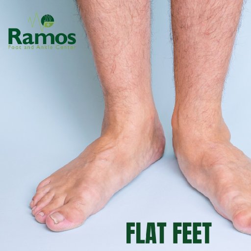 Plantar Wart Hands Perth Amboy